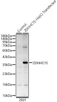 ZDHHC15 Rabbit pAb