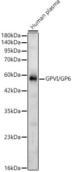 GPVI/GP6 Rabbit pAb