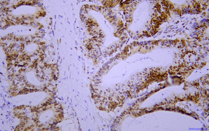 Postmeiotic Segregation Increased 2(PMS2)(PT2116)Mouse Monoclonal Antibody