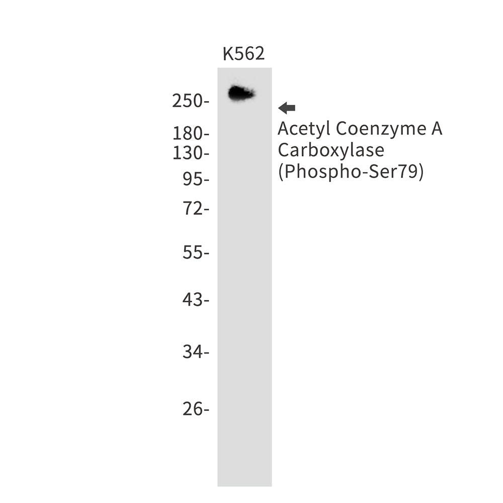 Phospho-Acetyl Coenzyme A Carboxylase (Ser79) Rabbit Monoclonal Antibody