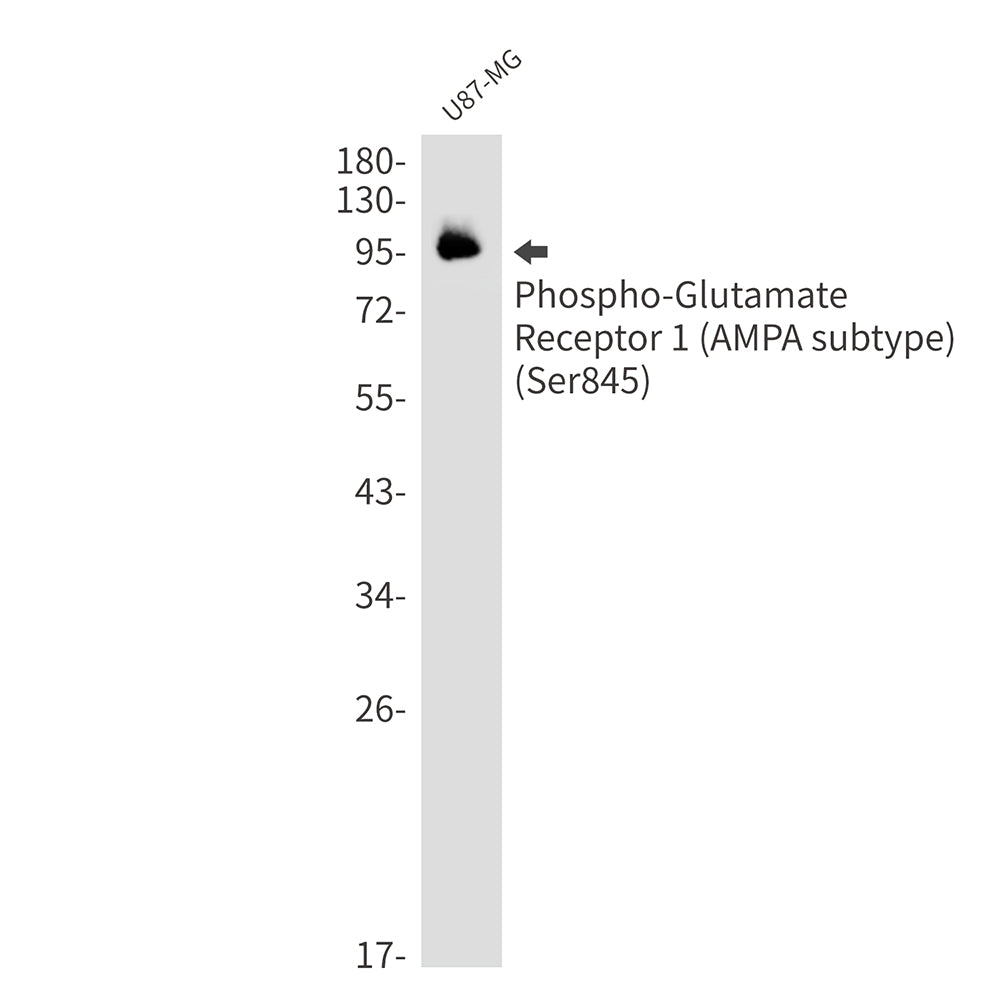 Phospho-Glutamate Receptor 1 (AMPA Subtype) (Ser845) Rabbit Monoclonal Antibody
