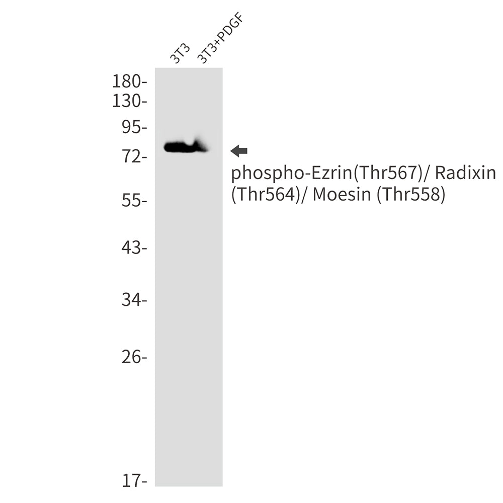 Phospho-Ezrin/Radixin/Moesin (Thr567/Thr564/Thr558) Rabbit Monoclonal Antibody