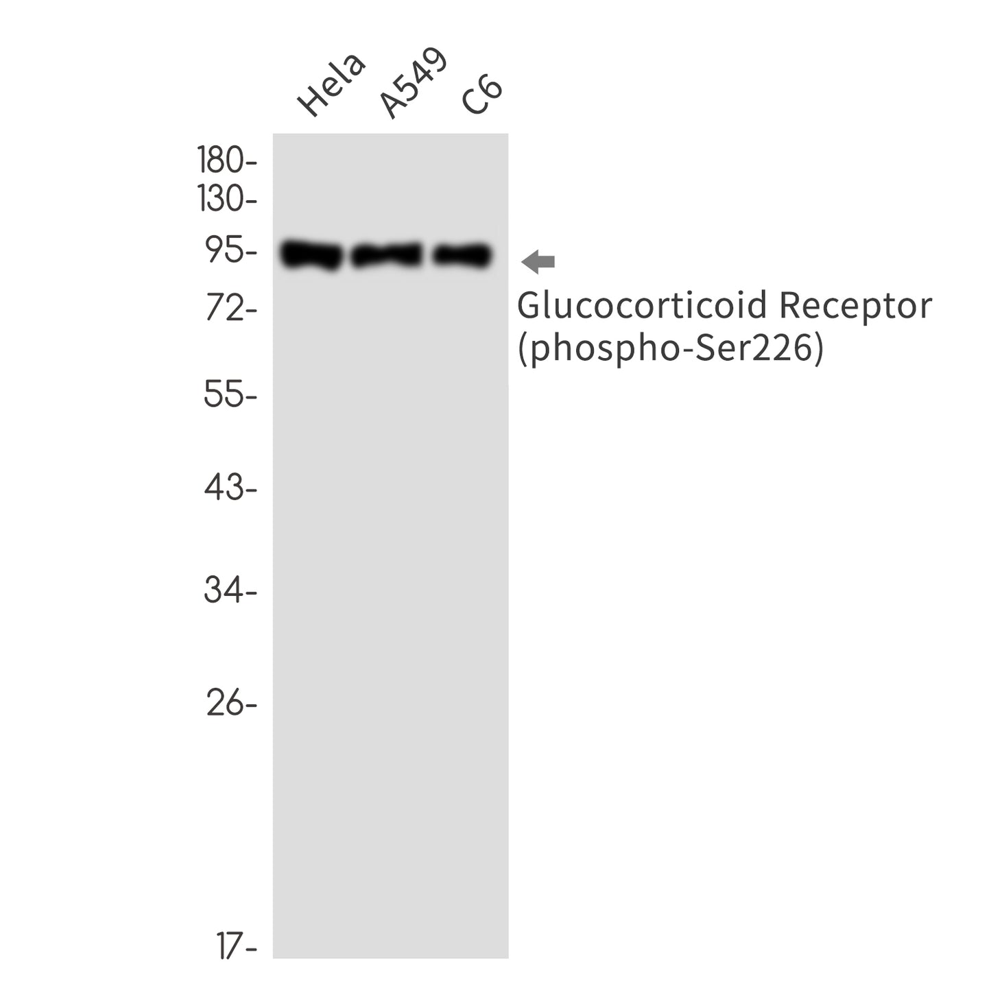 Phospho-Glucocorticoid Receptor (Ser226) (12W11) Rabbit Monoclonal Antibody