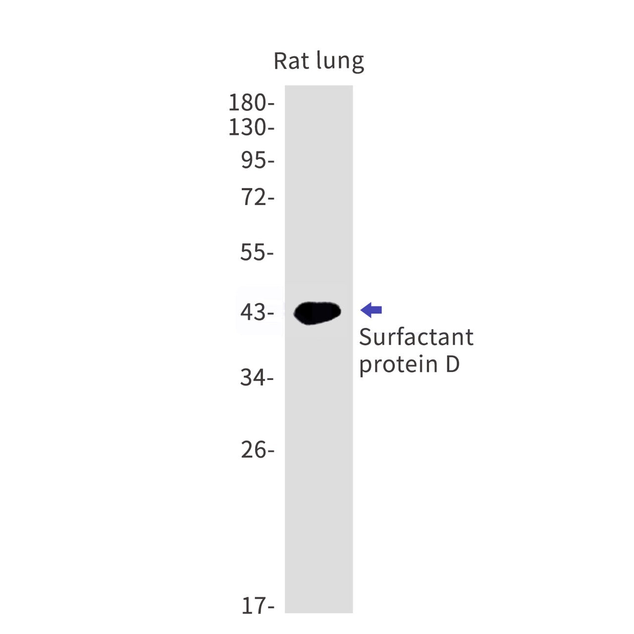 Pulmonary Surfactant Associated Protein D (13G17) Rabbit Monoclonal Antibody
