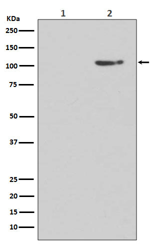 Phospho-Glutamate Receptor 1 (AMPA Subtype) (Ser845) Rabbit Polyclonal Antibody