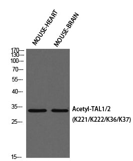 TAL1/2 (Acetyl Lys221/Acetyl Lys222/Acetyl Lys36/Acetyl Lys37) Rabbit Polyclonal Antibody