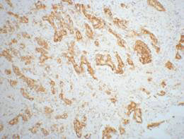 AMACR Monoclonal Antibody