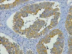 KRT19 Monoclonal Antibody