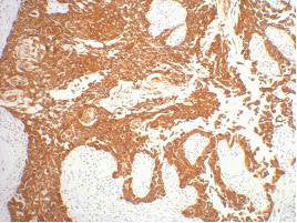 KRT16 Monoclonal Antibody