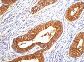 CEACAM5 Monoclonal Antibody