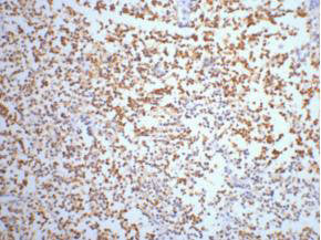 ENO2 Monoclonal Antibody