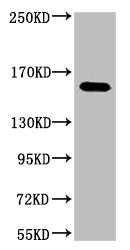 ERBB2 Monoclonal Antibody