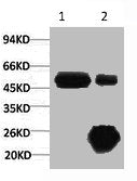 KRT17 Monoclonal Antibody