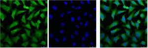 KRT18 Monoclonal Antibody