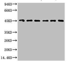 KRT18 Monoclonal Antibody