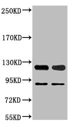 PARP1 Monoclonal Antibody