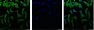 EIF4A1 Monoclonal Antibody