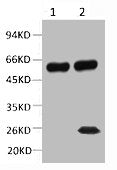 TUBB2A Monoclonal Antibody