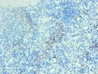 Hemoglobin Monoclonal Antibody