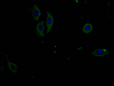 Phospho-PERK(T981)Monoclonal Antibody