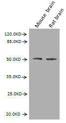 GFAP Monoclonal Antibody