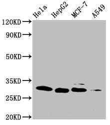 GSTM3 Monoclonal Antibody
