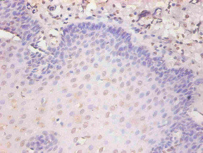 KRT19 Monoclonal Antibody