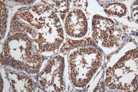 MAGEA4 Monoclonal Antibody