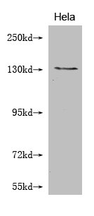 NOS2 Monoclonal Antibody