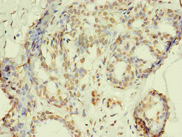 RRM1 Monoclonal Antibody