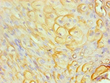 S100A8 Monoclonal Antibody
