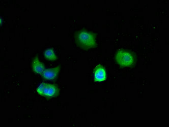 TFF3 Monoclonal Antibody