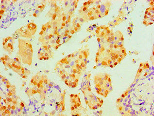 TP53 Monoclonal Antibody