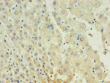 AFP Monoclonal Antibody