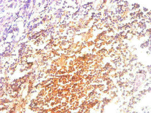 B2M Monoclonal Antibody