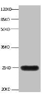 LCN2 Monoclonal Antibody