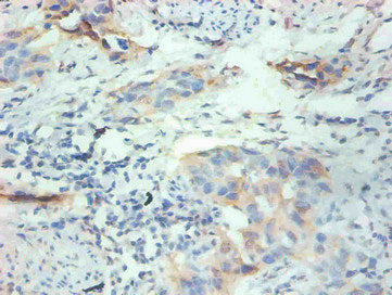 FABP3 Monoclonal Antibody