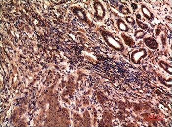 TUBG1 Monoclonal Antibody