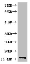 TTR Monoclonal Antibody