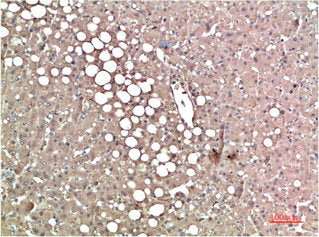 TTR Monoclonal Antibody
