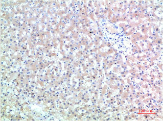 TTR Monoclonal Antibody