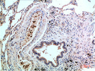 MAPK14 Monoclonal Antibody