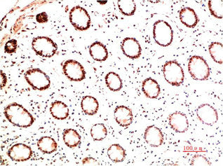 COL1A1 Monoclonal Antibody