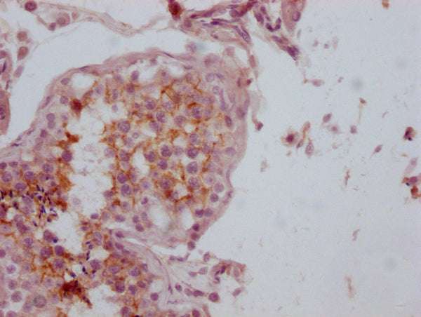 CD99 Monoclonal Antibody