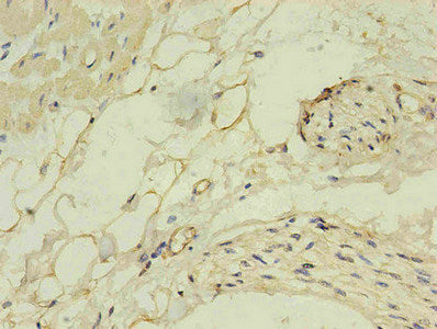 NPPB Monoclonal Antibody