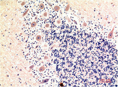 MAP1LC3B Monoclonal Antibody