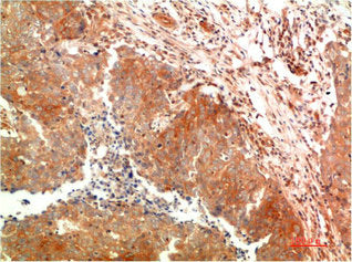 ATG5 Monoclonal Antibody