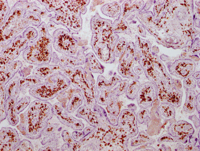 F13A1 Monoclonal Antibody