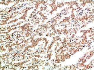 JAK2 Monoclonal Antibody