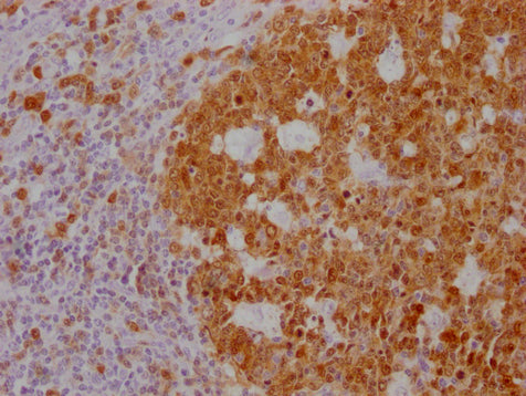 POU2AF1 Monoclonal Antibody